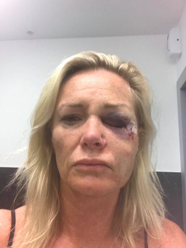 This is a picture of Karen Sadler a women king hit in Ibiza after a Tinder date.